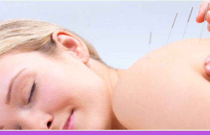 Acupuncture-Banner-Coral-Gables-FL Acupuncture-Banner-Coral-Gables-FL